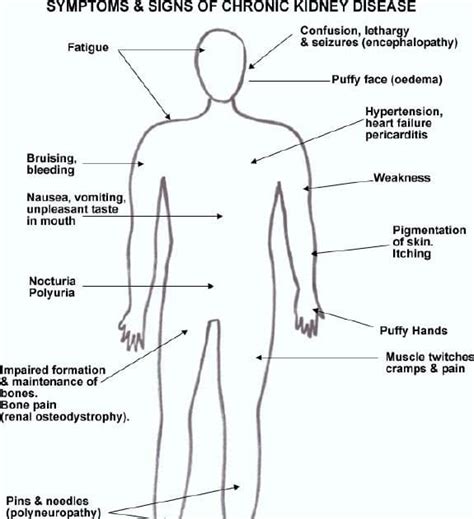 Where Do You Itch With Kidney Disease - HealthyKidneyClub.com