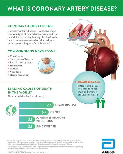 St. Mary’s Regional Heart Institute advances cardiology service by offering first-of-its-kind ...