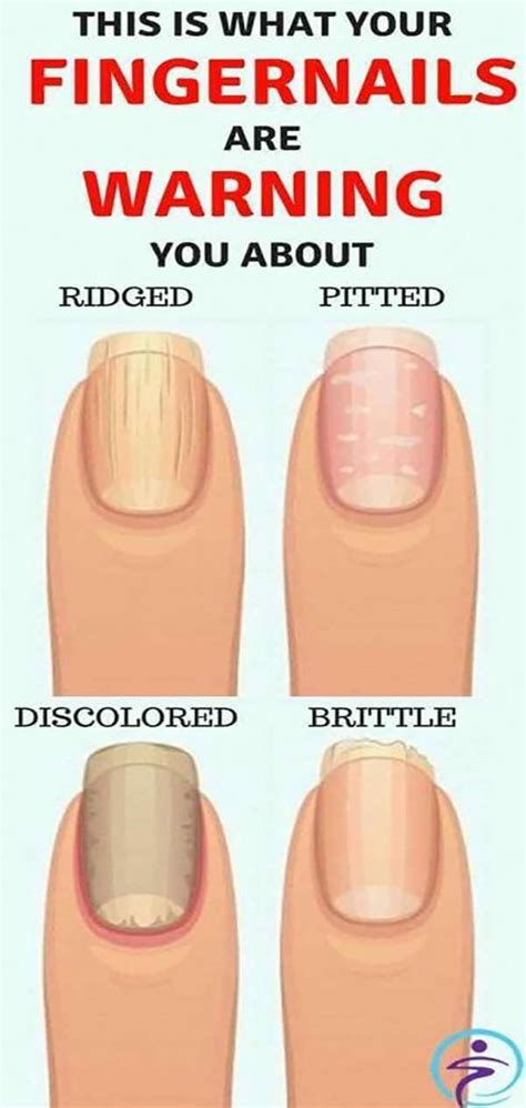 This Is What Your Fingernails Say About Your Health | Fingernail health, Healthy fingernails ...