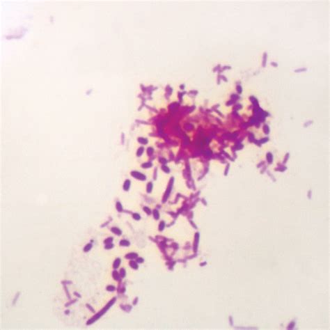 Pseudomonas aeruginosa, w.m. Microscope Slide | Carolina.com