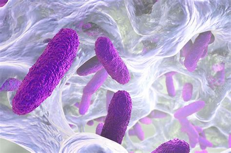 Klebsiella pneumoniae infection causes, symptoms, diagnosis, treatment & prognosis