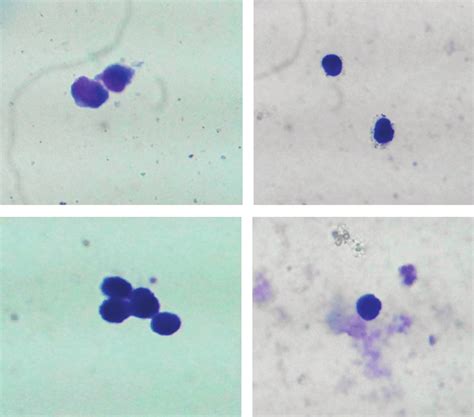 Microscopic analysis of k562 cell differentiation after 48 hours. A.... | Download Scientific ...