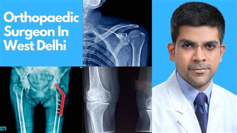 Best orthopaedic Surgeon In West Delhi | Dr Kunal Aneja 20+ Exp