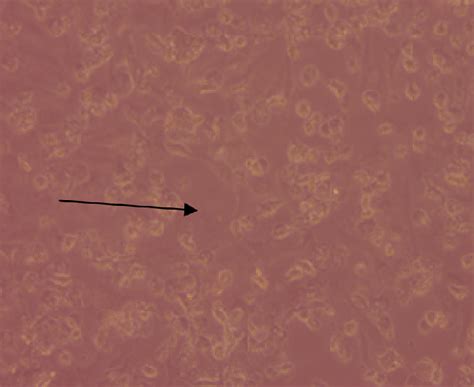 Cytopathic effect on 72 hpi; almost entire dissociation of cell ...