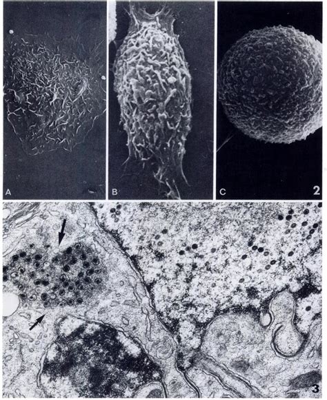 Scanning electron mlcrographs of macrophages from Infected cultures 3 d ...