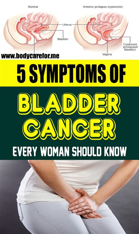 5 Symptoms Of Bladder Cancer Every Woman Should Know