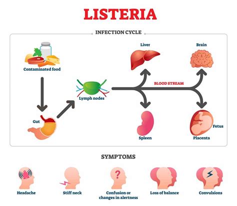 Refrigerators and Dangerous Listeria Infections