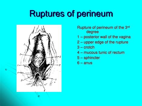 Maternal trauma. obstetric surgeries