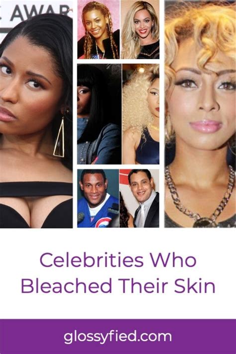 Celebrities Who Bleached Their Skin in 2021 | Beyonce skin, Celebrities, Bright skin