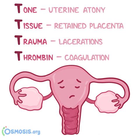 Postpartum Hemorrhage