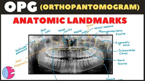 Orthopantomogram (OPG) Anatomical Landmarks / Panoramic Radiography ...