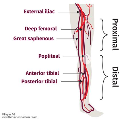 Deep VT Introduction and Diagnosis | Thrombosis Adviser