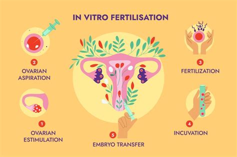 Steps in In-Vitro Fertilization (IVF) - Yashoda Hospital