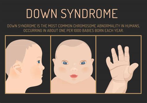 Down Syndrome Child Portrait stock vectors - iStock