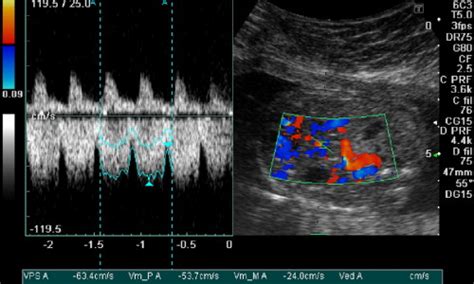 Ultrasound - Greenville, SC - EmergencyMD | Advanced Urgent Care