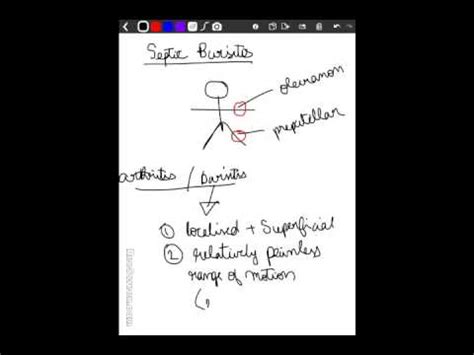 septic bursitis - YouTube