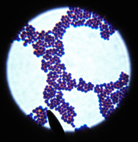 Staphylococcus Epidermidis Gram Stain