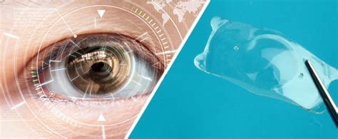 Comparison of LASIK and ICL - Which Surgery is Preferred for Whom?