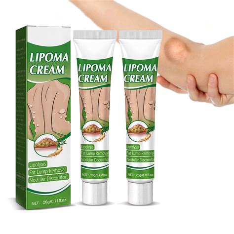 Buy LipomaCure Soothing Ointment, LumpFree Lipoma Removal Cream, al ...