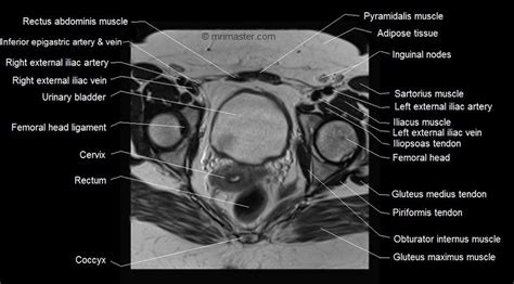 Pin on Pelvis anatomy