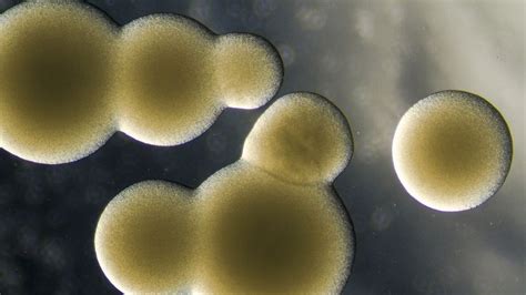 Saccharomyces cerevisiae colonies under a stereo microscope. | Yeast, Beer brewing process ...