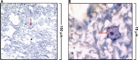 [PDF] Adipose Tissue and Inflammation | Semantic Scholar