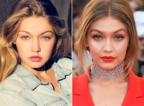 Gigi Hadid, Before and After | Gigi hadid plastic surgery, Gigi hadid, Gigi hadid before