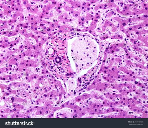 Portal Triad Histology Labeled