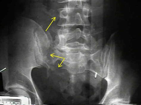 Wheeless' Textbook of Orthopaedics