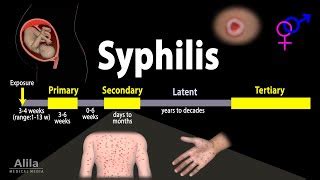 Syphilis