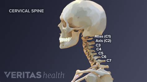 Causas y Factores de Riesgo de cefalea cervicogénica | TJMBB