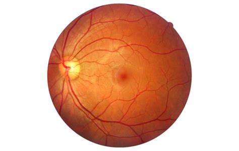 Retinal Imaging: How it Works & Why It's Important | Visionary Eye Centre