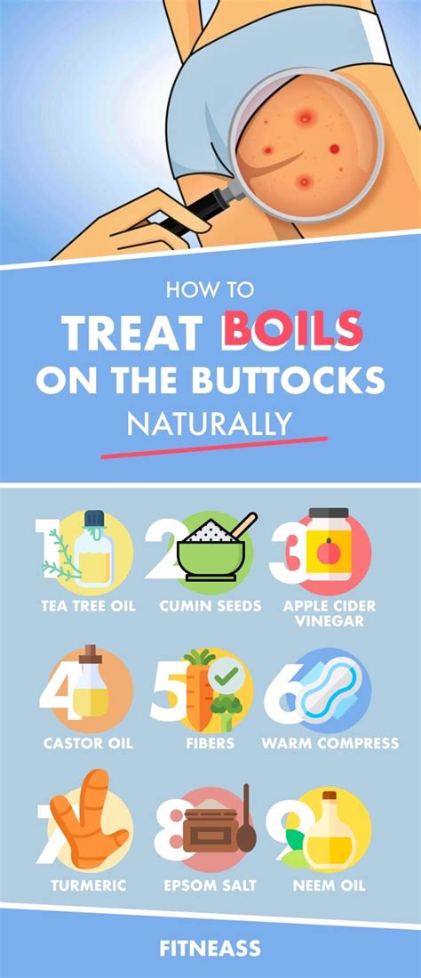 How To Treat Boils On The Buttocks With Natural Remedies - Fitneass