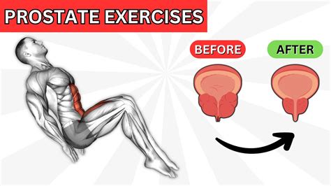 TOP 7 Kegel Exercises to SHRINK an ENLARGED PROSTATE – WeightBlink