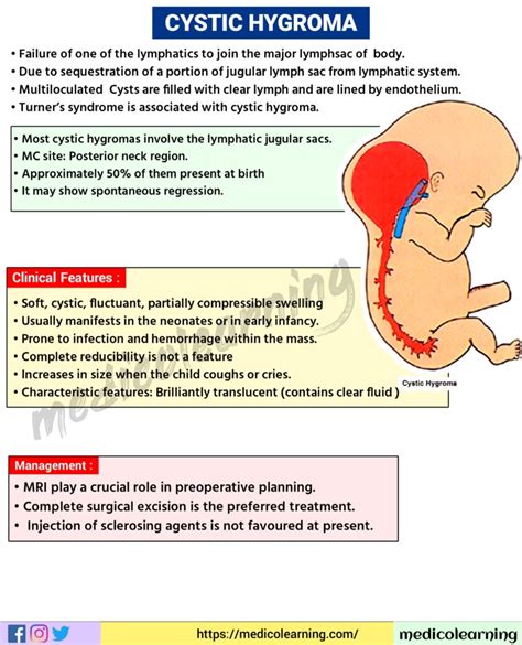 Cystic Hygroma – MedicoLearning