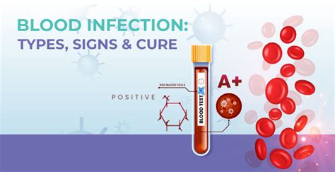 Know About Blood Infections - Types, Signs, Symptoms & Treatment | MrMed