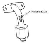 Fenestrated Vs Non-Fenestrated Tracheostomy Tube, 56% OFF