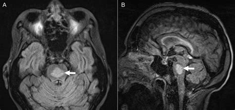 Southwest Journal of Pulmonary, Critical Care and Sleep - Imaging - Medical Image of the Week ...