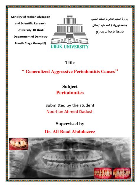 Generalized Aggressive Periodontitis Causes | PDF | Periodontology | Diseases And Disorders