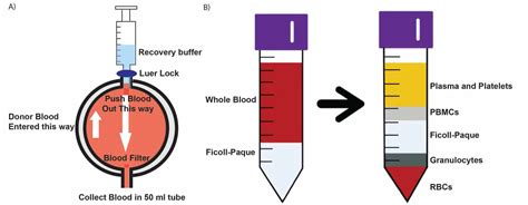 Cureus | In Vitro Macrophage-Mediated Phagocytosis Assay of Brain Tumors