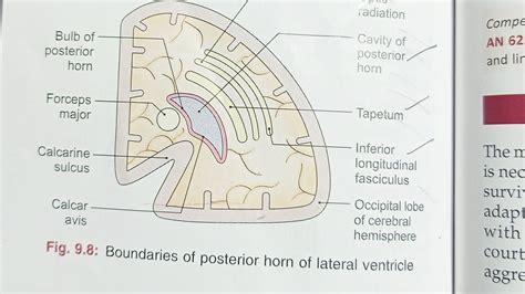 5.Posterior Horn of Lateral Ventricle (Boundaries).: Neuroanatomy Diagrams. - YouTube