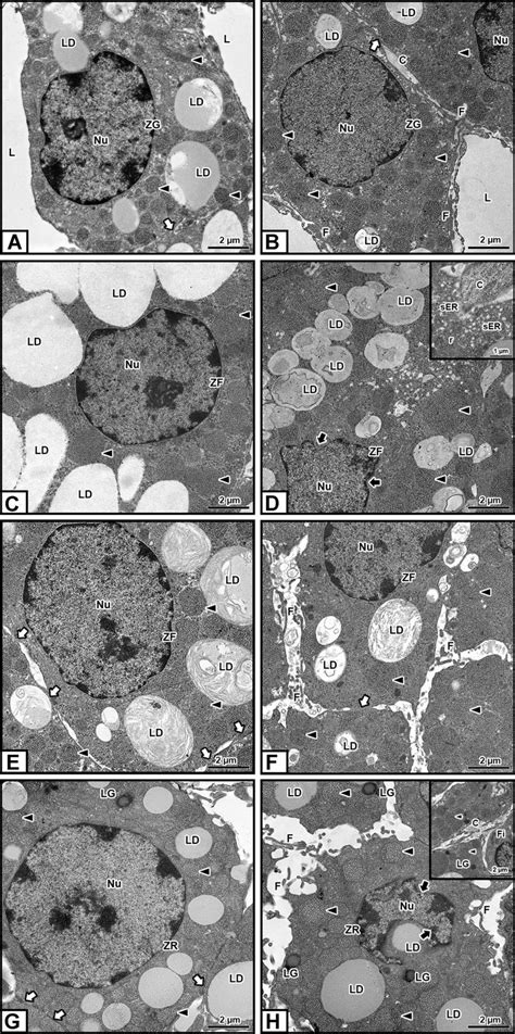 Transmission electron micrographs of zona glomerulosa cells (ZG)... | Download Scientific Diagram