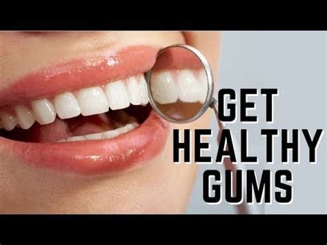 What Vitamin Helps Keep Teeth And Gums Healthy? – Bestorium