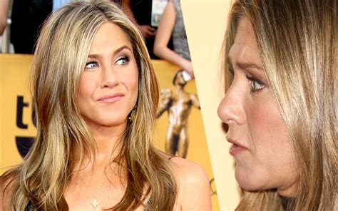 Jen Aniston's Surgery Secrets — She Gets Botox & Fillers, Docs Say