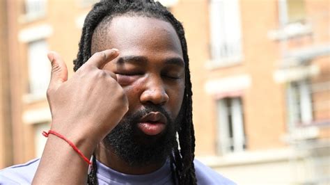 French anti-cop activist claims police brutality (VIDEO) — RT World News