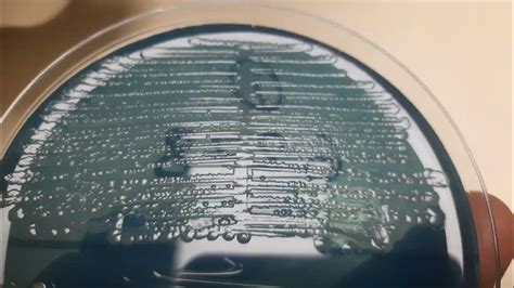 Proteus mirabilis Colony morphology on CLED agar - YouTube