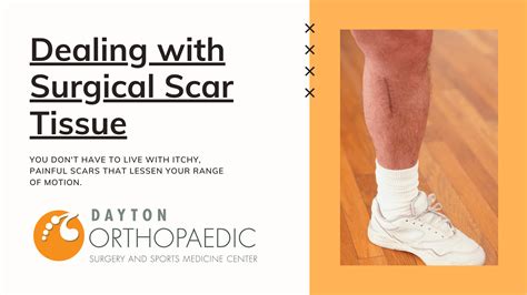 Dealing With Surgical Scar Tissue - Dayton Orthopaedic Surgery