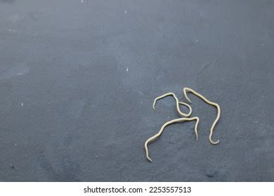 Pinworms (threadworms): Symptoms, Causes, And Treatments, 54% OFF