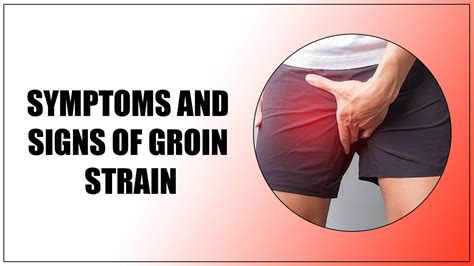 Expert Physical Therapy Guide to Recover Groin Strain – Oklahoma ...