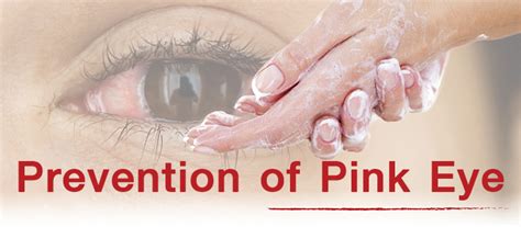 Conjunctivitis or Pinkeye Symptoms and Treatments